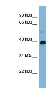 GAPDH Antibody (aa107-156)
