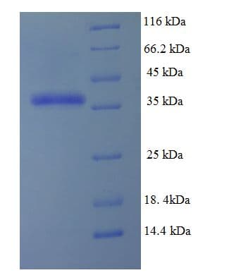 Human DHFR Protein (Recombinant His-SUMO)