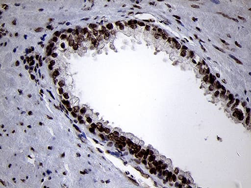 SMC1A / SMC1 Antibody (aa889-1016, clone OTI3G4, Carrier-free)
