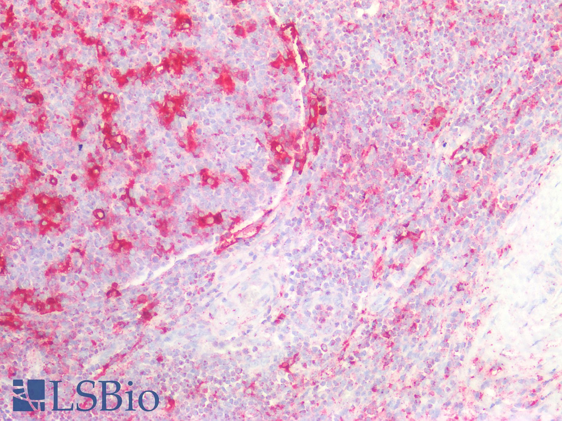 PathPlus™ Polyclonal Rabbit anti-Human CTSD / Cathepsin D Antibody (aa72-292, IHC, WB)