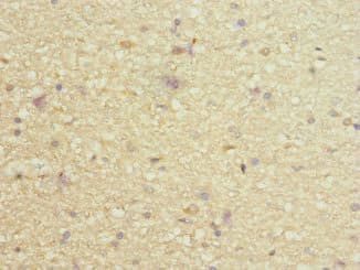 Polyclonal Rabbit anti-Human PIEZO1 / FAM38A Antibody (IHC)