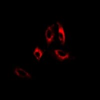 GAD65 Antibody