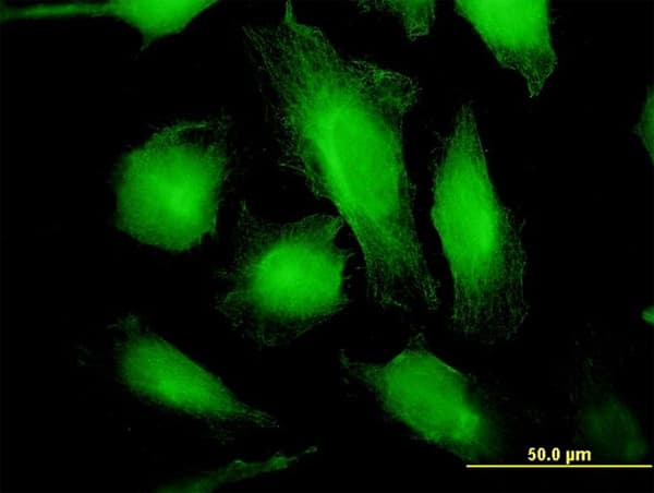 WARS Antibody (clone 3A12)
