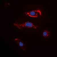 FGF22 Antibody (Internal)