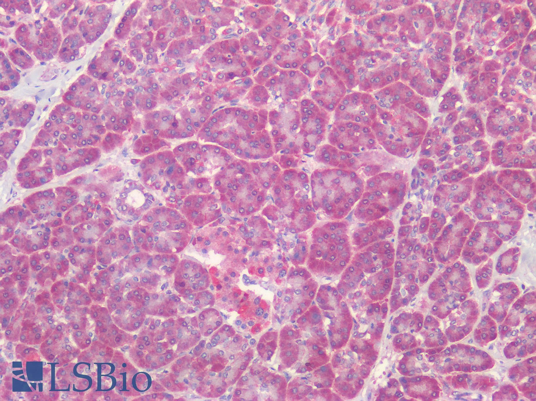 IHC-plus™ TIRC7 / TCIRG1 Antibody (C-Terminus)