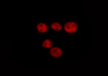 LMNA / Lamin A+C Antibody (phospho-Ser392)