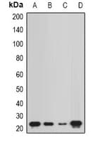 Polyclonal Rabbit anti-Human NCS1 / Neuronal Calcium Sensor Antibody (IF, WB)