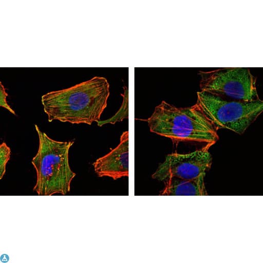 CRTC1 / MECT1 / TORC1 Antibody