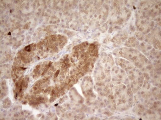 PROCR / EPCR Antibody (aa1-210, clone UMAB201, Carrier-free)