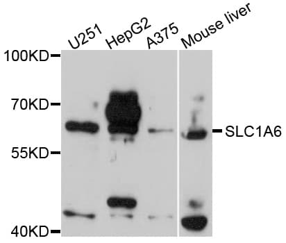 SLC1A6 / EAAT4 Antibody