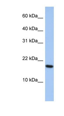 ARL5A / ARL5 Antibody (aa107-156, Biotin)