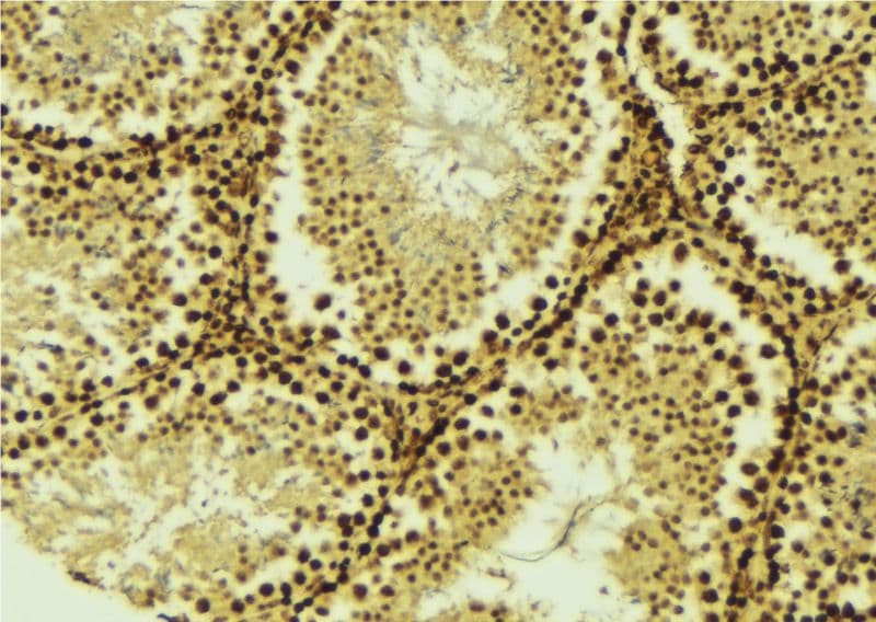 STK36 Antibody