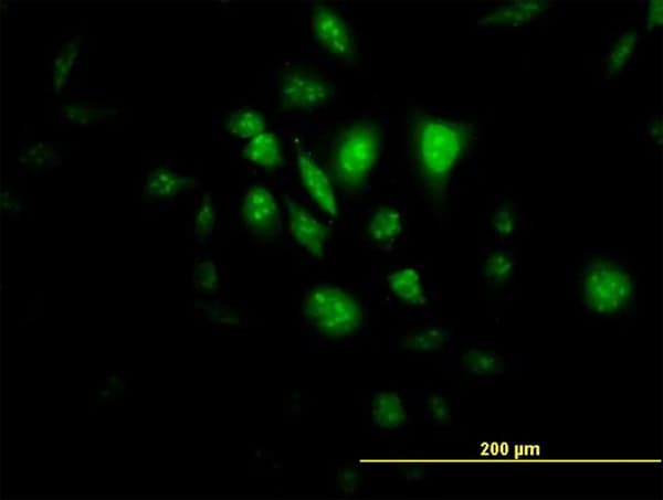 IHC-plus™ STK33 Antibody (clone 3F10)