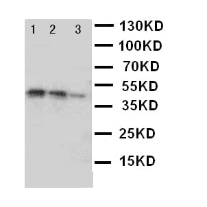 Polyclonal Rabbit anti-Human DDR2 Antibody (aa834-855, WB)
