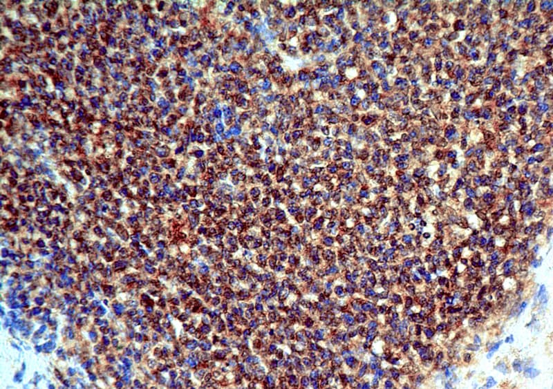 TNFRSF9 / 4-1BB / CD137 Antibody