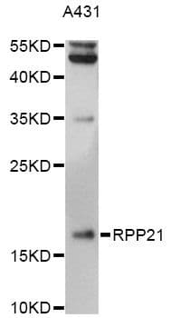 Polyclonal Rabbit anti-Human RPP21 Antibody (WB)