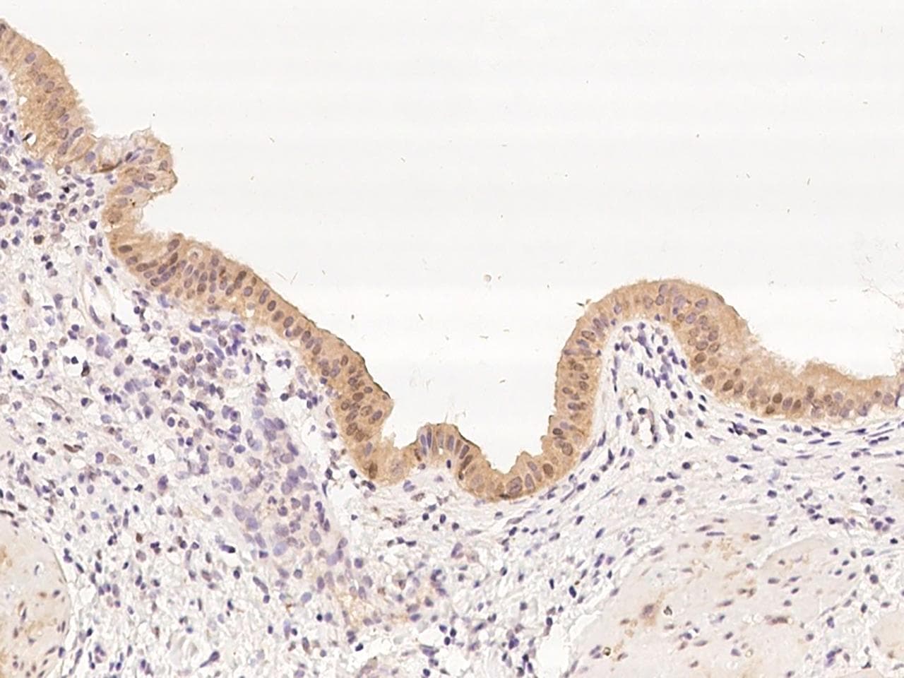 PTGR2 / PGR2 Antibody