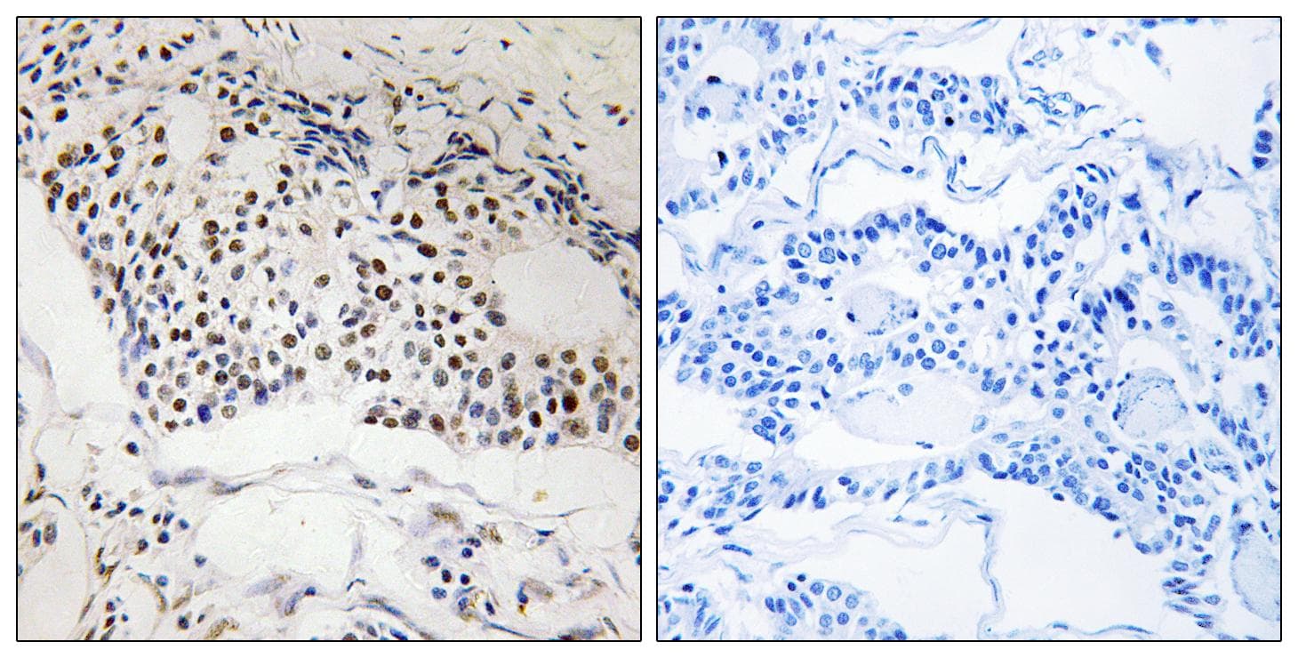 MYSM1 Antibody