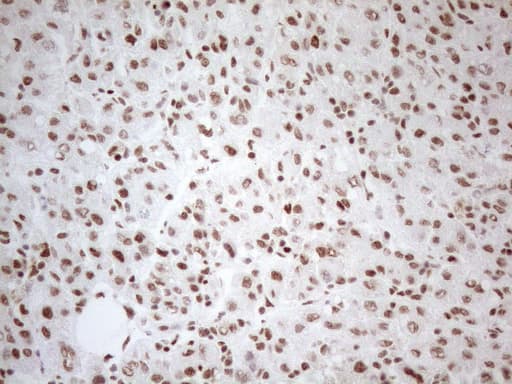Monoclonal Mouse anti-Human WTAP Antibody (clone OTI12G7, aa2-106, IHC, WB)