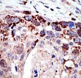 ATXN3 / JOS Antibody (aa29-59)