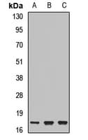 Polyclonal Rabbit anti-Human UBE2N / UBC13 Antibody (WB)