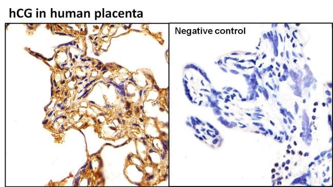 Monoclonal Mouse anti-Human hCG / Chorionic Gonadotropin Antibody (clone 3002, IHC)