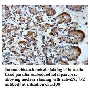 ZNF792 Antibody (aa180-472)