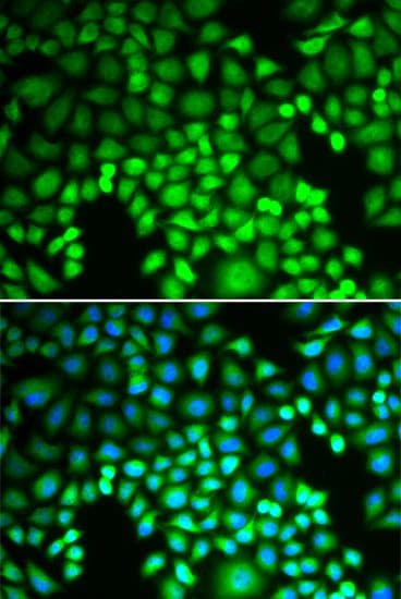 PSMA4 Antibody