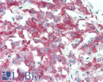 IHC-plus™ Polyclonal Rabbit anti-Human KISS1R / GPR54 Antibody (IHC, WB)