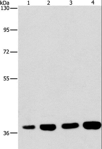 SERPINA9 Antibody