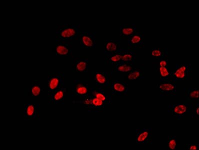 Polyclonal Rabbit anti-Human HIST1H3A Antibody (IHC, IF, WB)