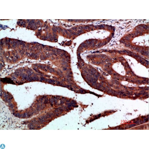 Polyclonal Rabbit anti-Human CDK6 Antibody (IHC, WB)