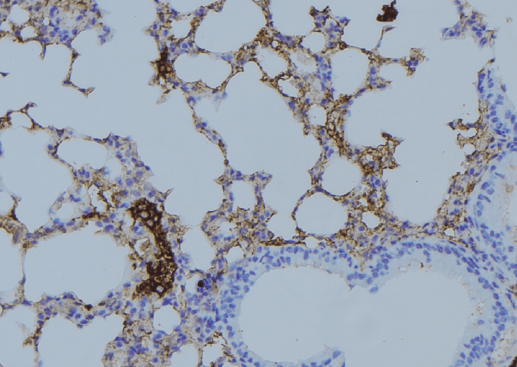 Polyclonal Rabbit anti-Human COPZ1 Antibody (IHC, IF, WB)