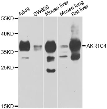 AKR1C4 / Chlordecone Reductase Antibody