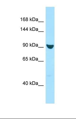 XPO7 / RANBP16 Antibody (aa1004-1053)