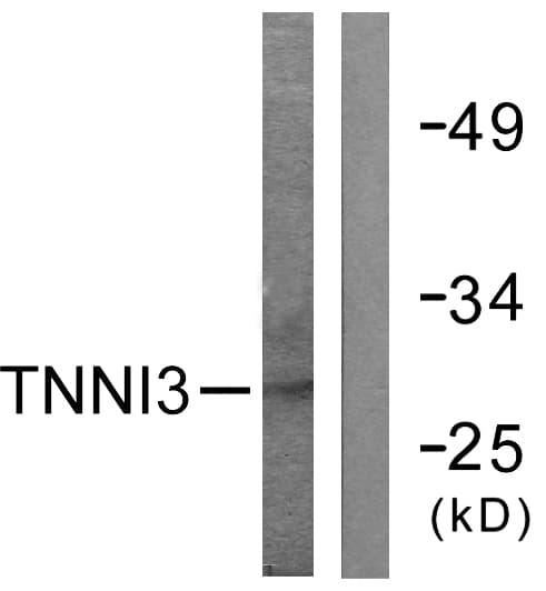 TNNI3 / Cardiac Troponin I Antibody (aa111-160)