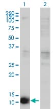 IHC-plus™ CSTB / Cystatin B / Stefin B Antibody (clone M2F1)