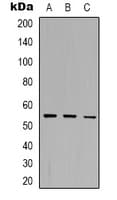 Polyclonal Rabbit anti-Human DOK7 Antibody (N-Terminus, WB)