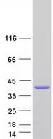 Human PARVG Protein (Recombinant Myc-DDK (Flag))