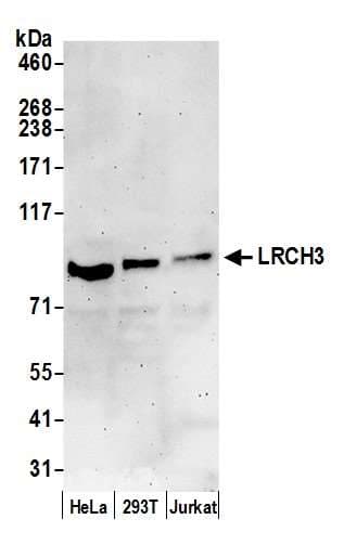 Polyclonal Rabbit anti-Human LRCH3 Antibody (aa500-550, WB)