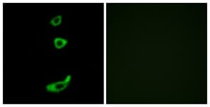 CRFR1 / CRHR1 Antibody (aa75-124)