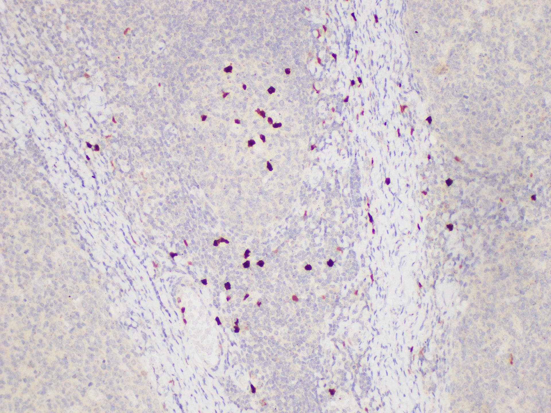 Polyclonal Rabbit anti-Human S100A12 Antibody (IHC)