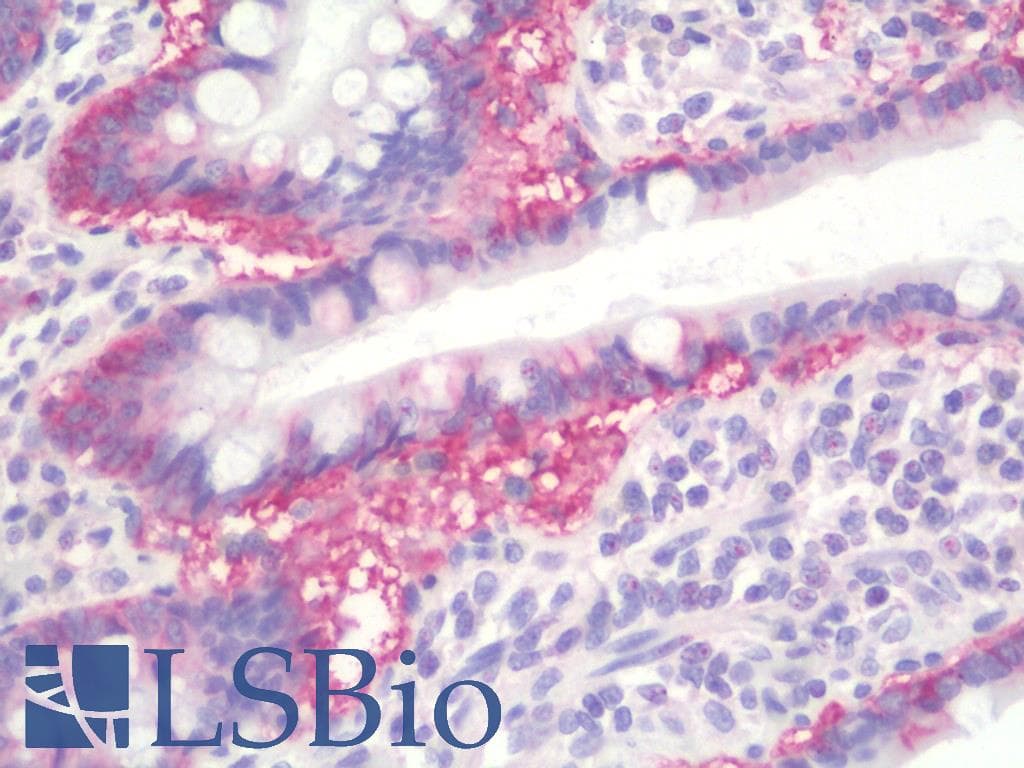 IHC-plus™ RAB1A Antibody (C-Terminus)