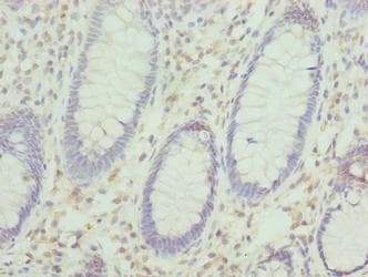 KHDRBS2 / SLM-1 Antibody