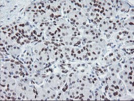 MEIS3 Antibody (aa1-261, clone OTI3E12, Carrier-free)