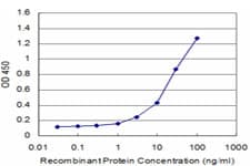 CDC42BPB / MRCKB Antibody (clone 2F4)