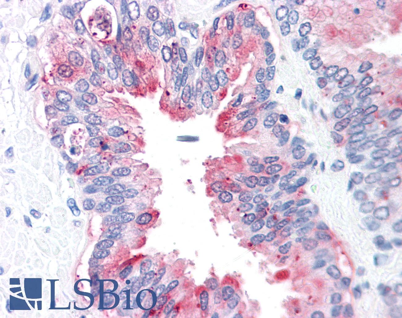 IHC-plus™ ADAM20 Antibody (Internal)