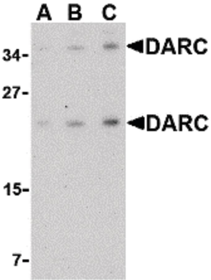IHC-plus™ ACKR1 / DARC Antibody