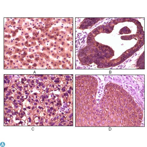 Monoclonal Mouse anti-Human CSNK1A1 / CK1 Alpha Antibody (IHC, WB)