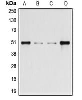 ARRB1 / Beta Arrestin 1 Antibody (phospho-Ser412)